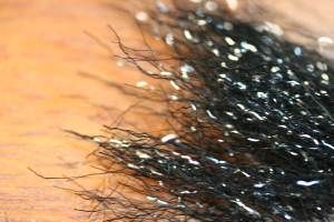 Creepy Crawley Ice Dub Black